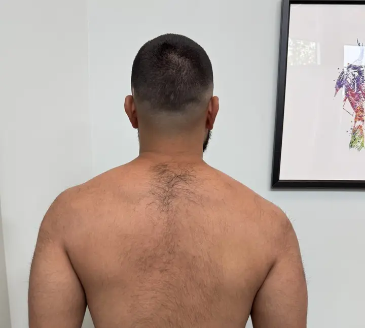 Shoulder Blade Set: Relaxed: shoulders neutral