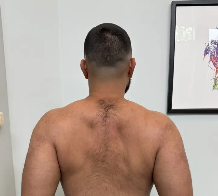 Shoulder Blade Set: Set: shoulder blades down and back